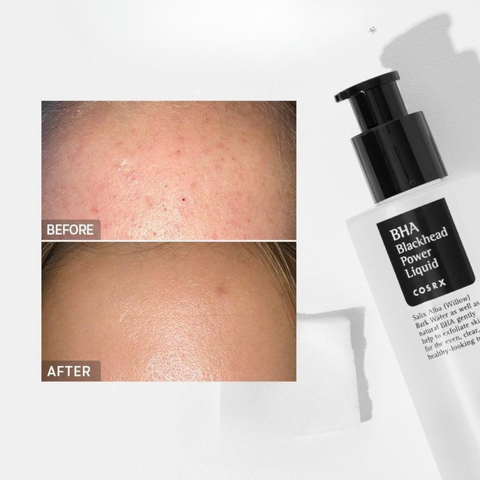 Solutie cu BHA impotriva punctelor negre, 100ml | COSRX