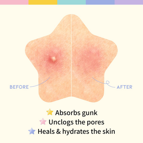 Plasturi hidrocolidali anti-acnee STAR SPOT PATCH, 80buc./5g | #OOTD