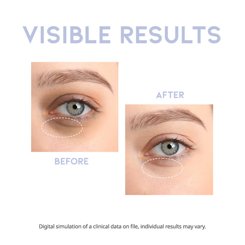 Serum intensiv de zi pentru zona ochilor cu acid hialuronic, cafeina si vitamina C, 30g | #OOTD