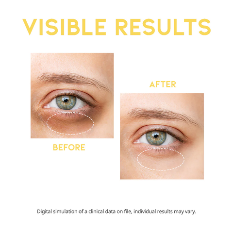 Serum anti-cearcane cu niacinamide, ceramide si vitamina C, 30g | #OOTD